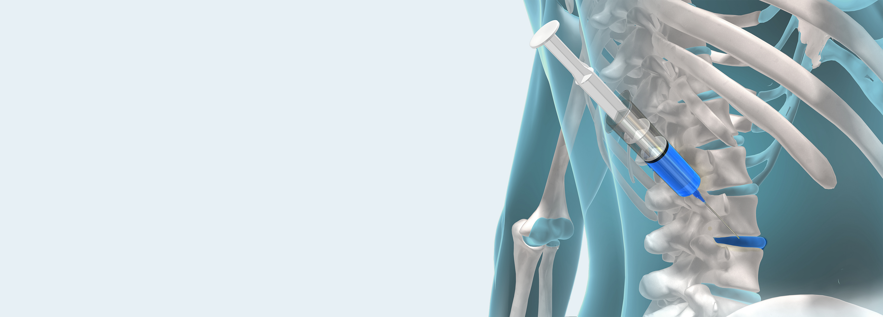 목허리통증 서울삼성정형외과의원