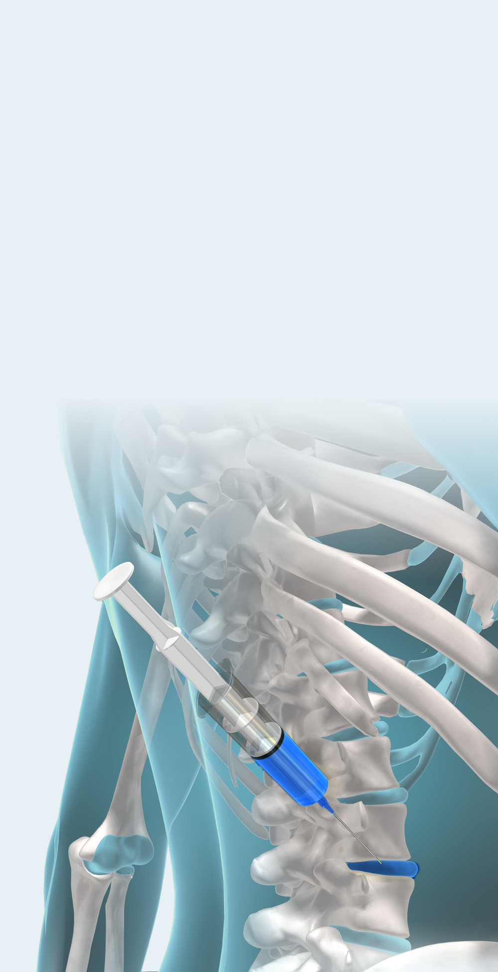 목허리통증 서울삼성정형외과의원