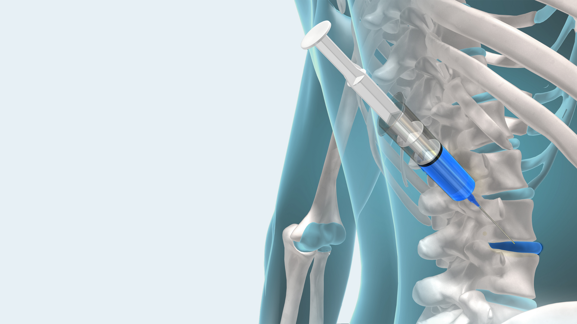 목허리통증 서울삼성정형외과의원